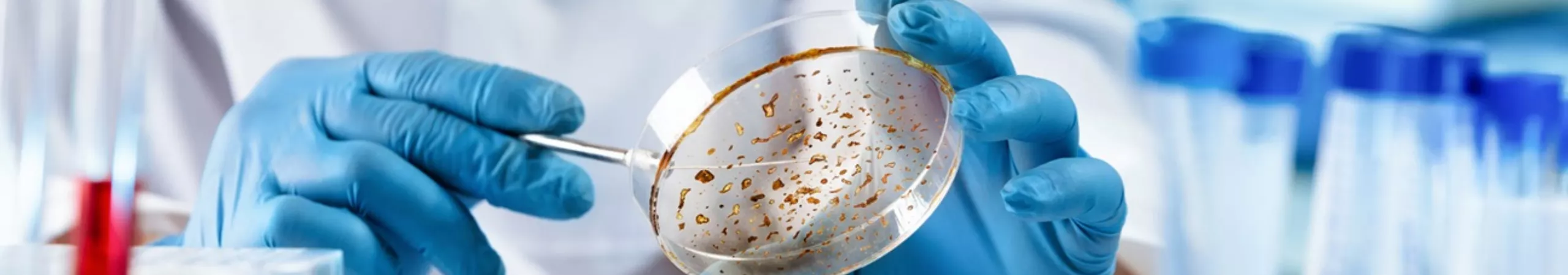 infectious-disease-69b00a8d3994d